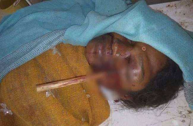 women attacked by arrow in sonbhadra  tribesman area