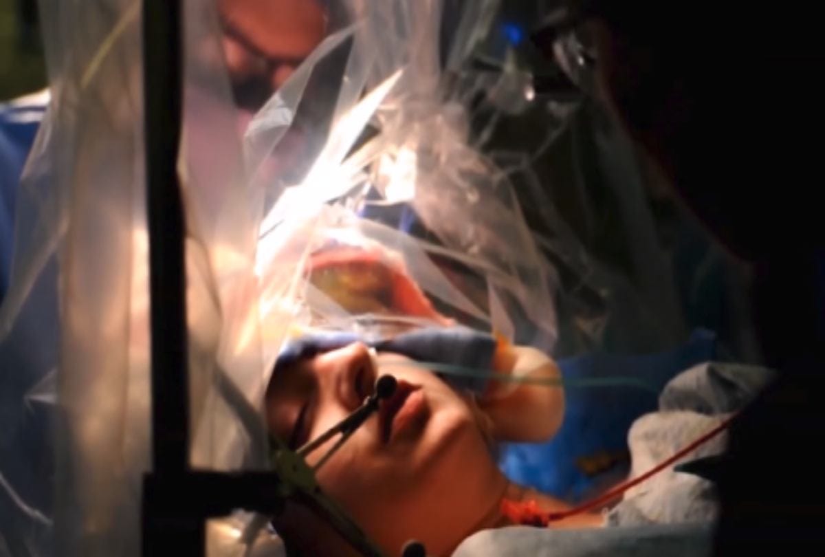 Patient Sings Songs And Jokes During Her Brain Tumour Surgery in Glasgow hospital