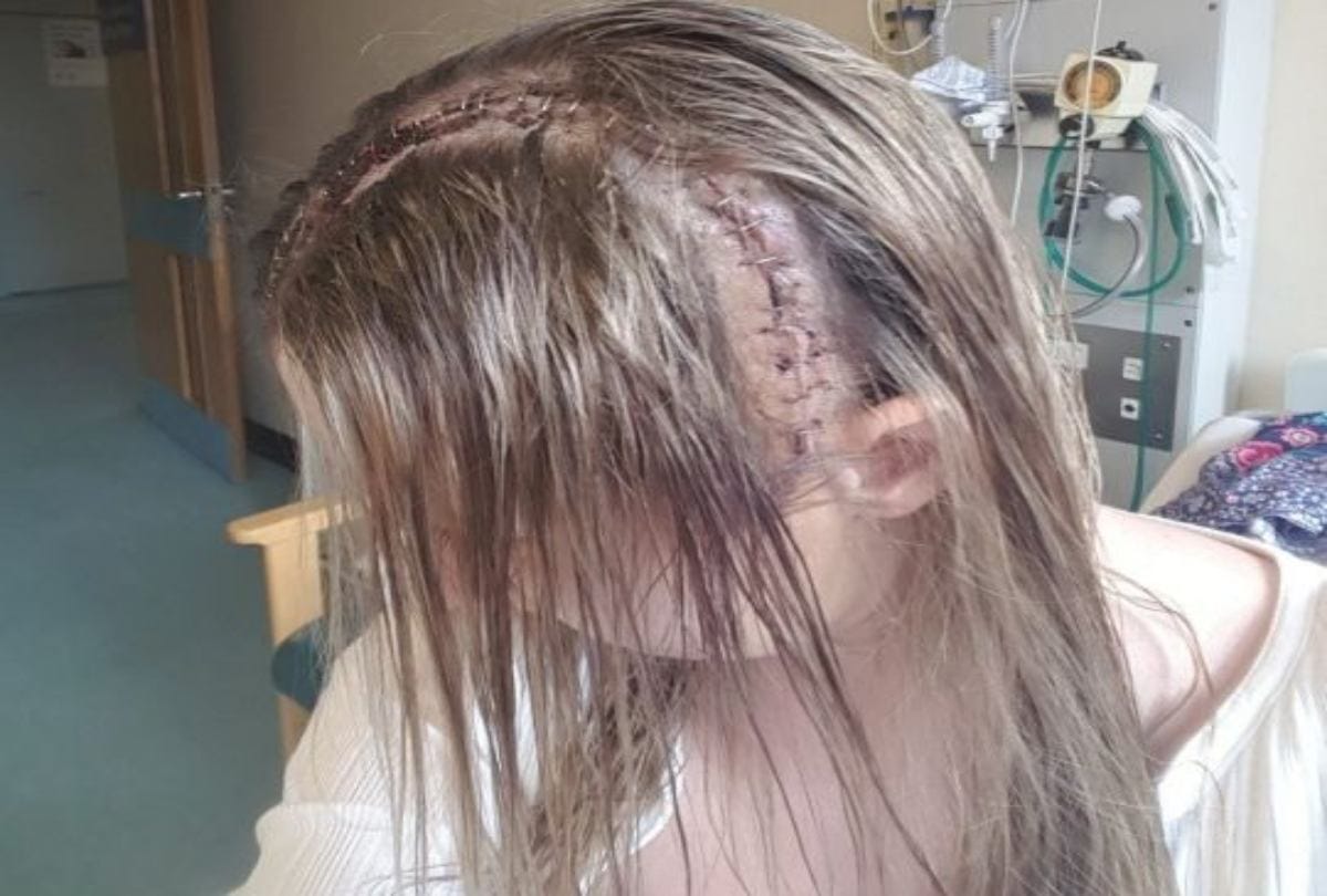 Patient Sings Songs And Jokes During Her Brain Tumour Surgery in Glasgow hospital