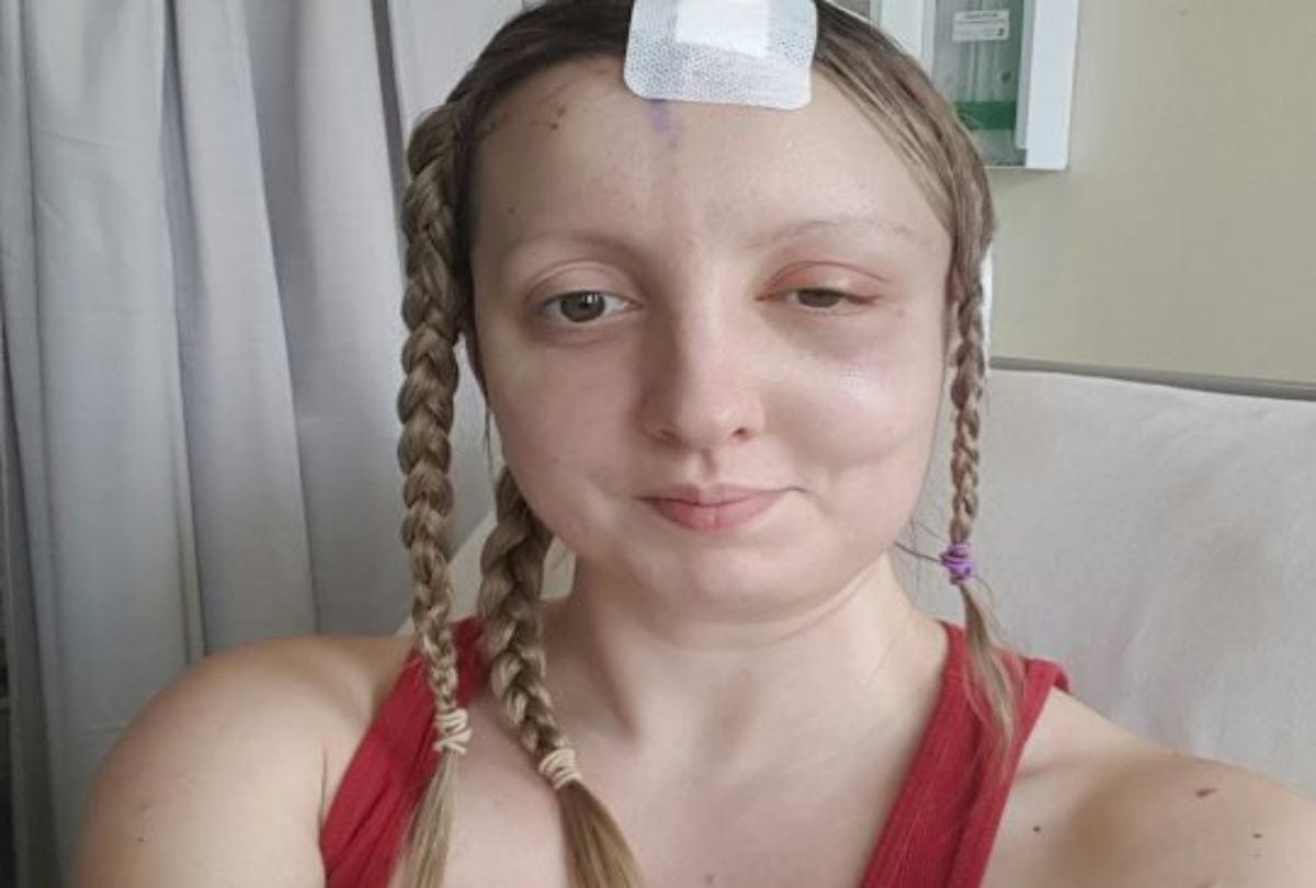 Patient Sings Songs And Jokes During Her Brain Tumour Surgery in Glasgow hospital