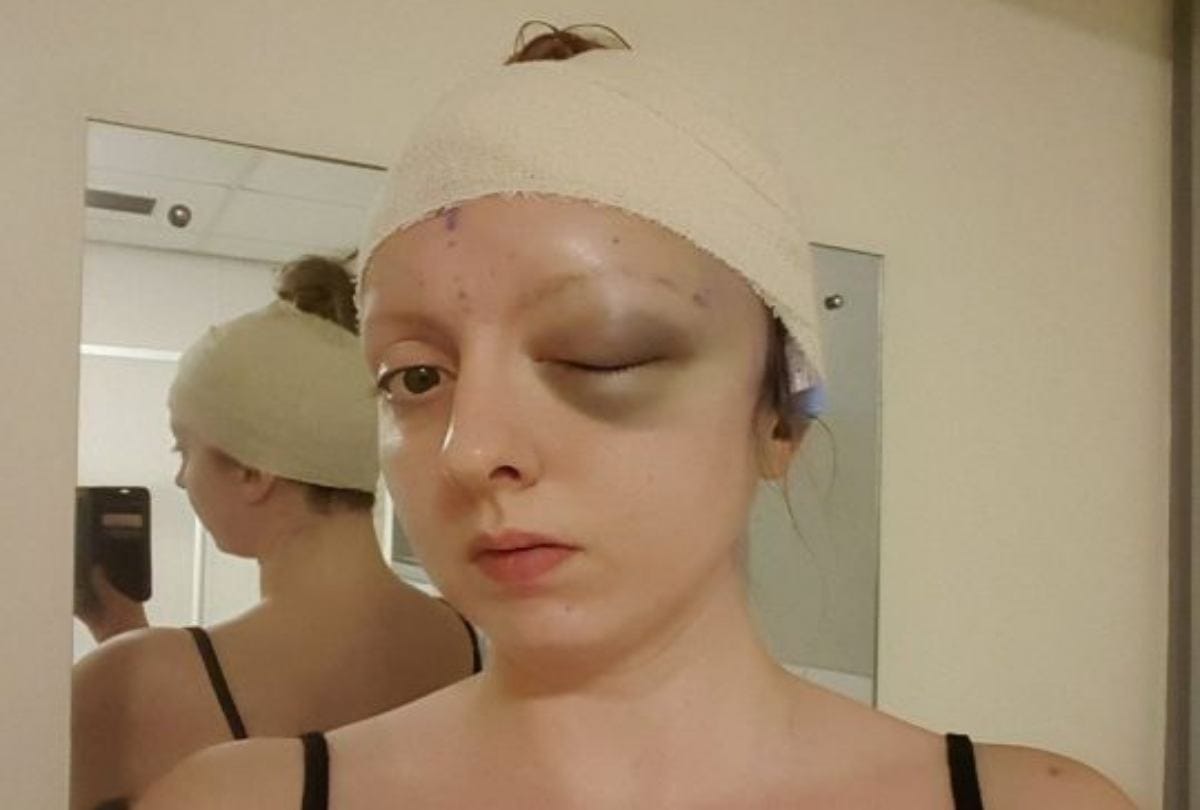 Patient Sings Songs And Jokes During Her Brain Tumour Surgery in Glasgow hospital