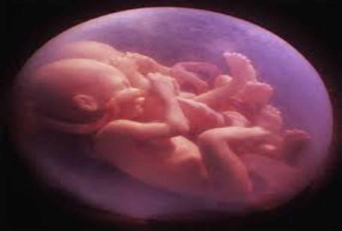 Baby hand out of the uterus and doctors refer pregnant woman to another hospital