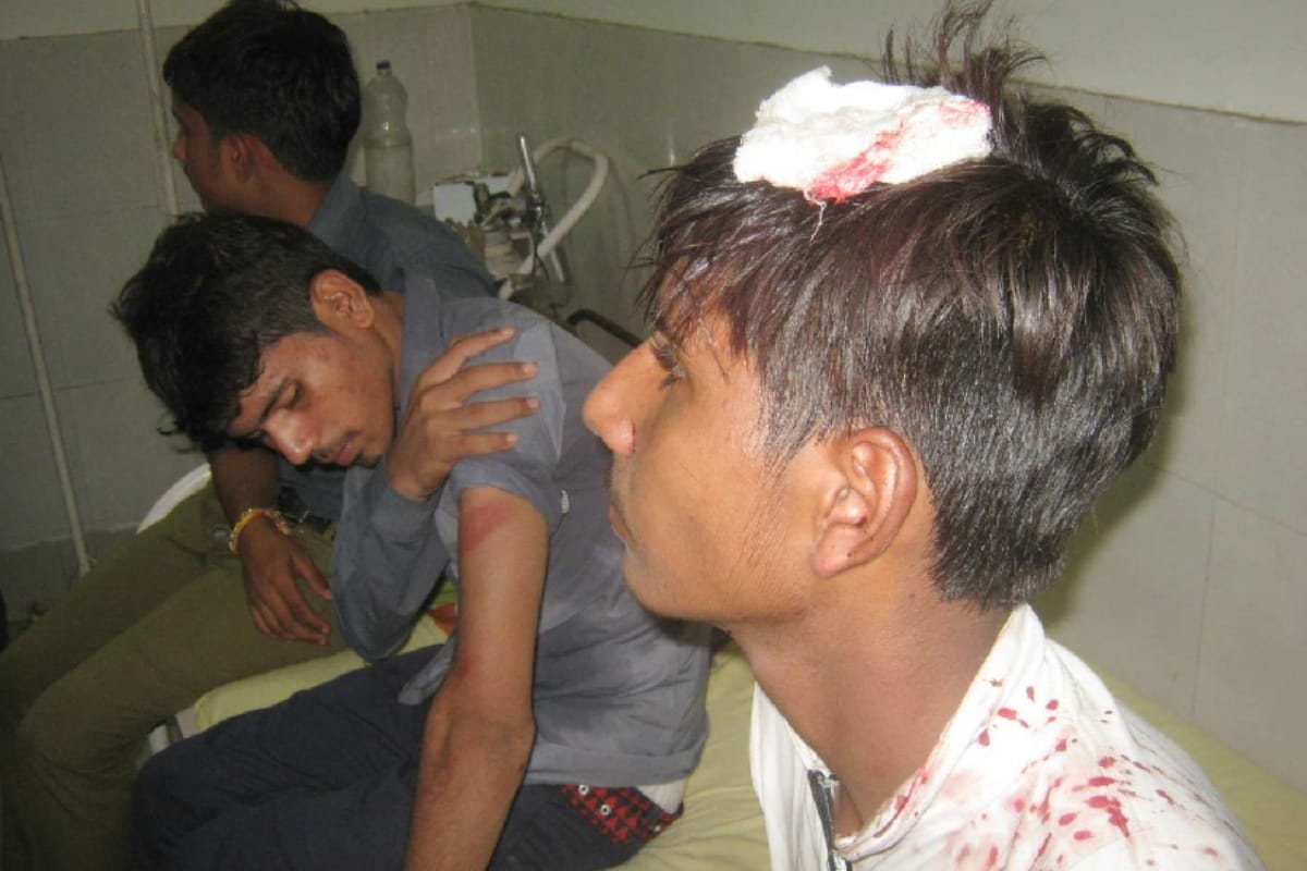 UP: Suddenly attack on the bus people screamed with fear many injured see in photos