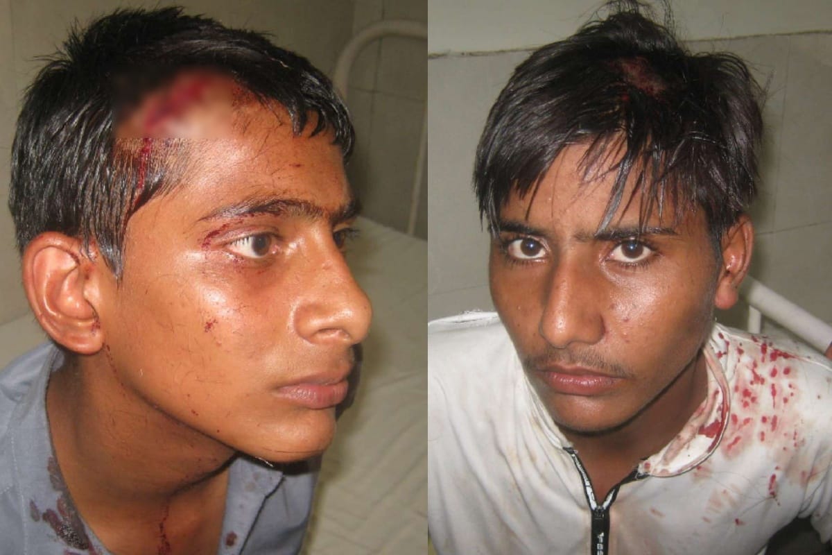 UP: Suddenly attack on the bus people screamed with fear many injured see in photos