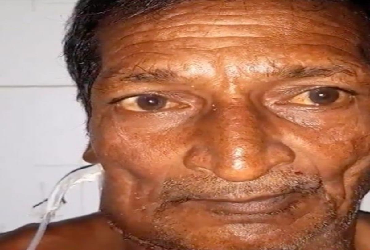 Farmer Saves Money to Have Surgery to Remove Tumor