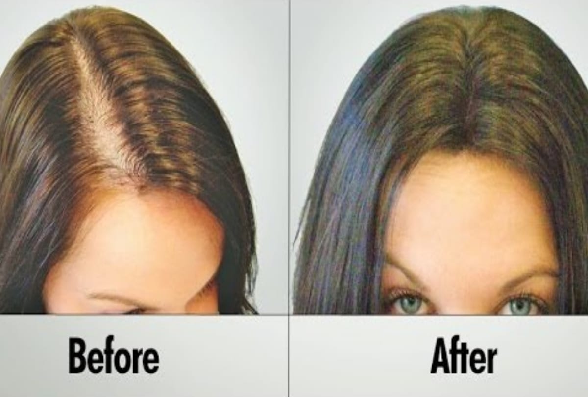 use flax seeds for hair growth