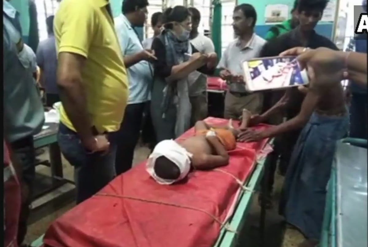 3 year old was shot during clashes that erupted in Malda over formation of Panchayat board