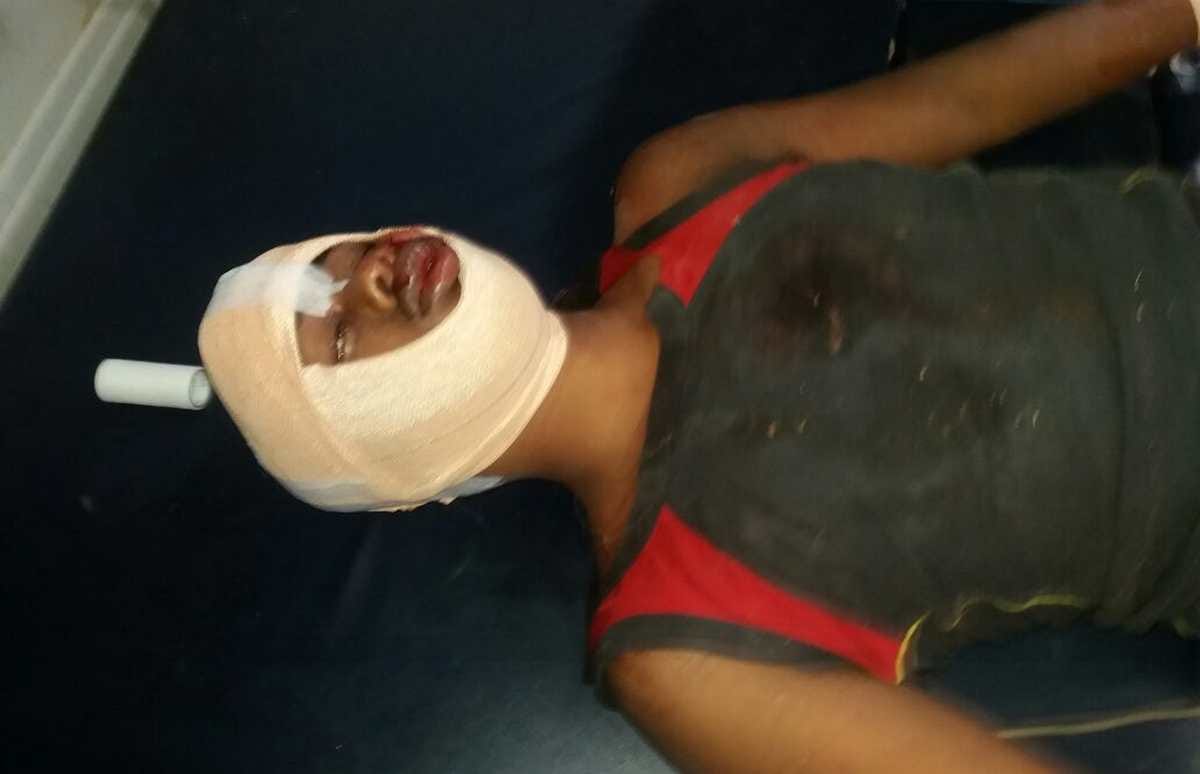 School bus hit his school student in varanasi