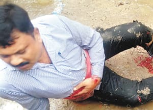 Deadly attack on pharmacist at Daranganj