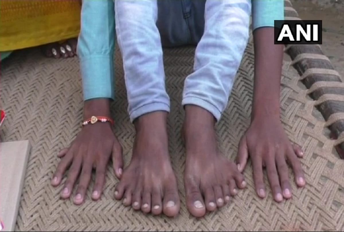 Barabanki boy born with 24 fingers Parents claim that relatives are trying to kill their son