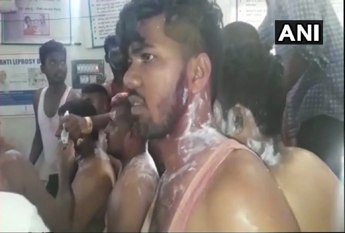 Congress workers injured by Acid attack in victory rally of Karnataka