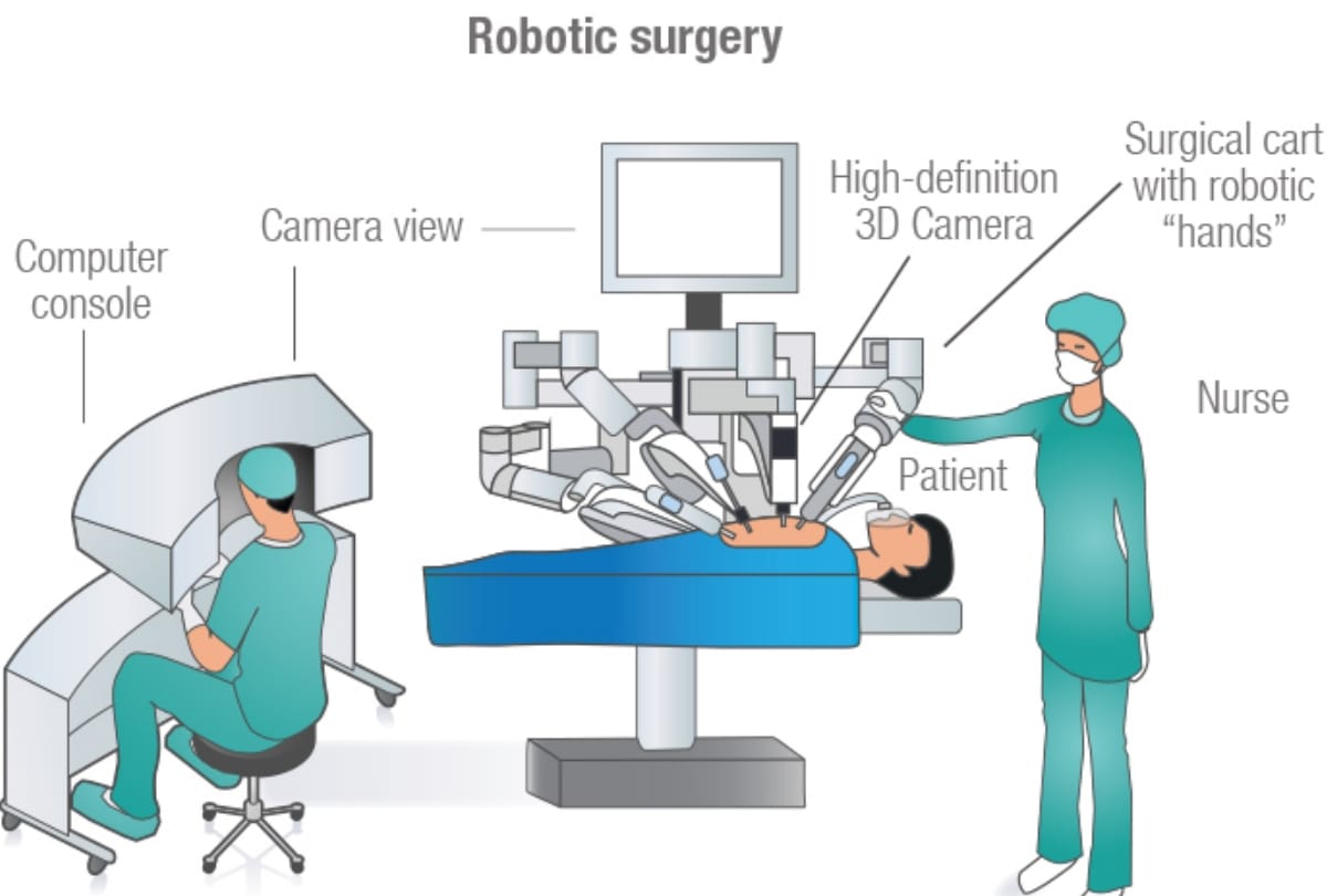 robotic surgery will start soon in SGPGI lucknow