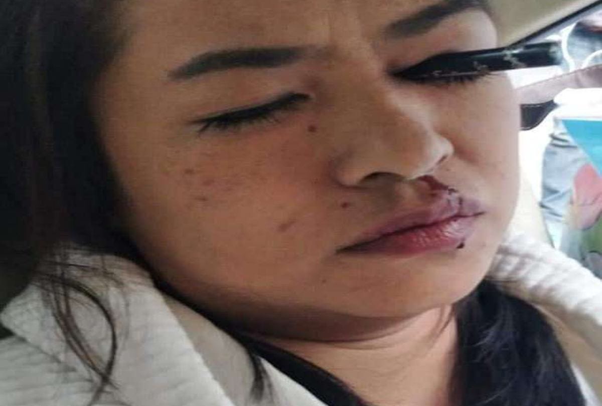 eyebrow pencil stuck in women eyes while doing makeup in moving car in bangkok