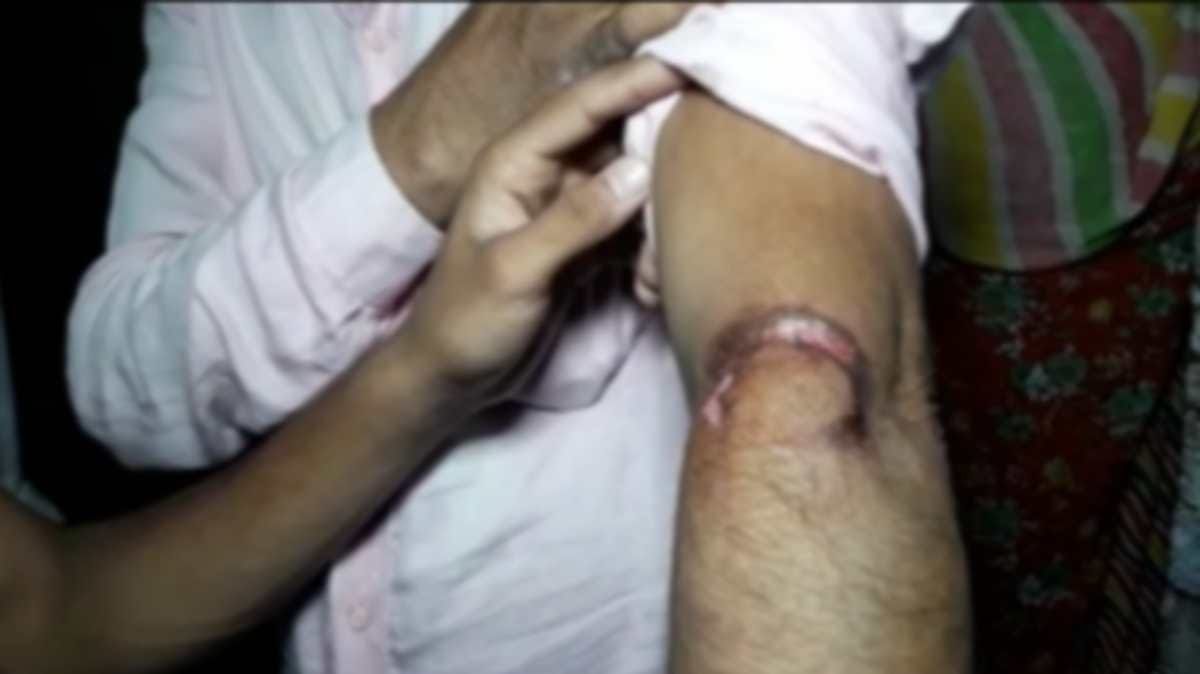 mad ass injured dozens of people at varanasi