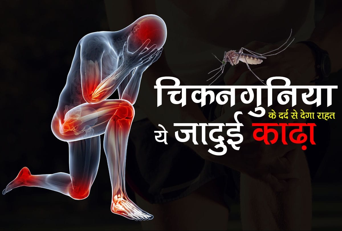 Chikungunya home remedy: Joint Pain After Chikungunya this remedy can help you