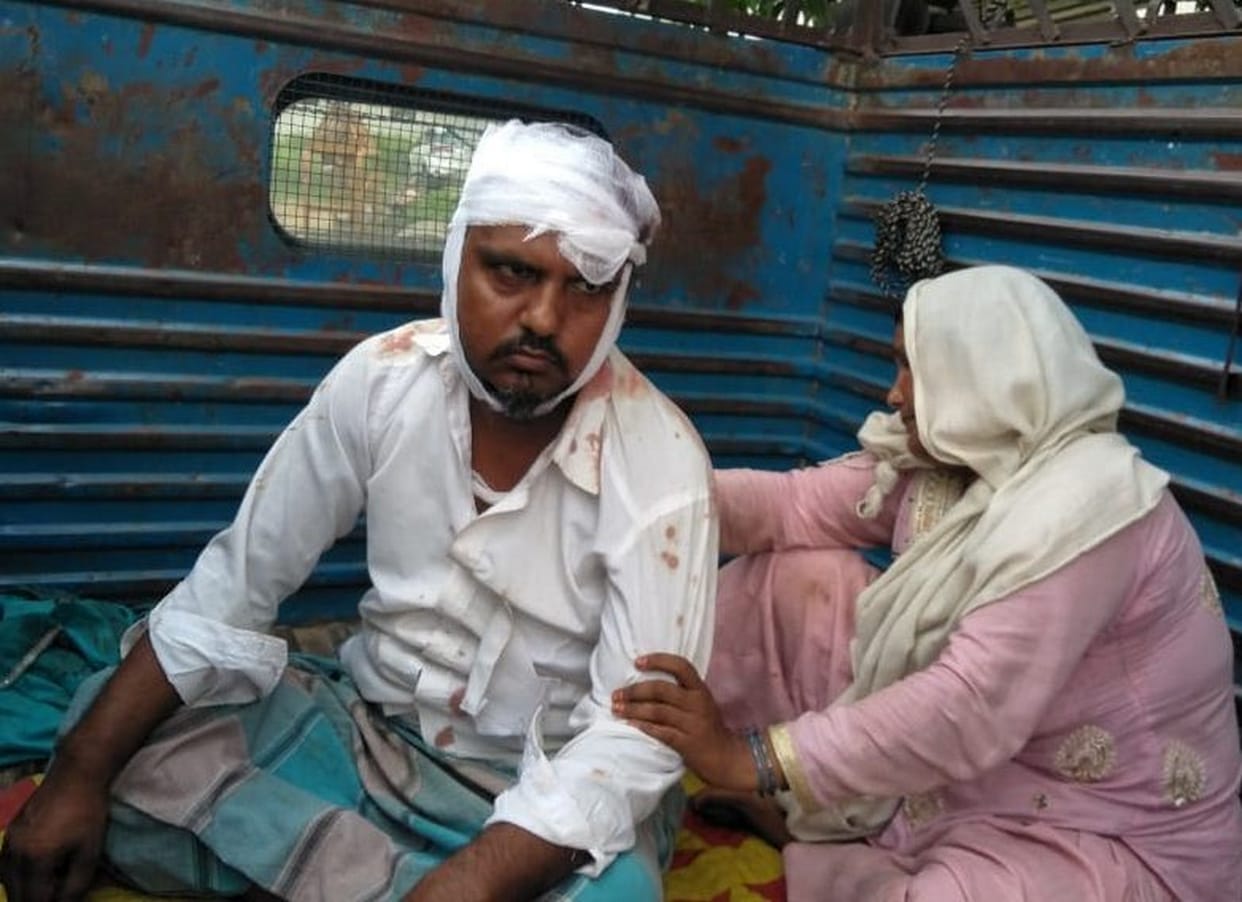 दो सगे भाइयों पर लोहे की पाइप से हमला, एक की मौत