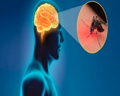Japanese encephalitis