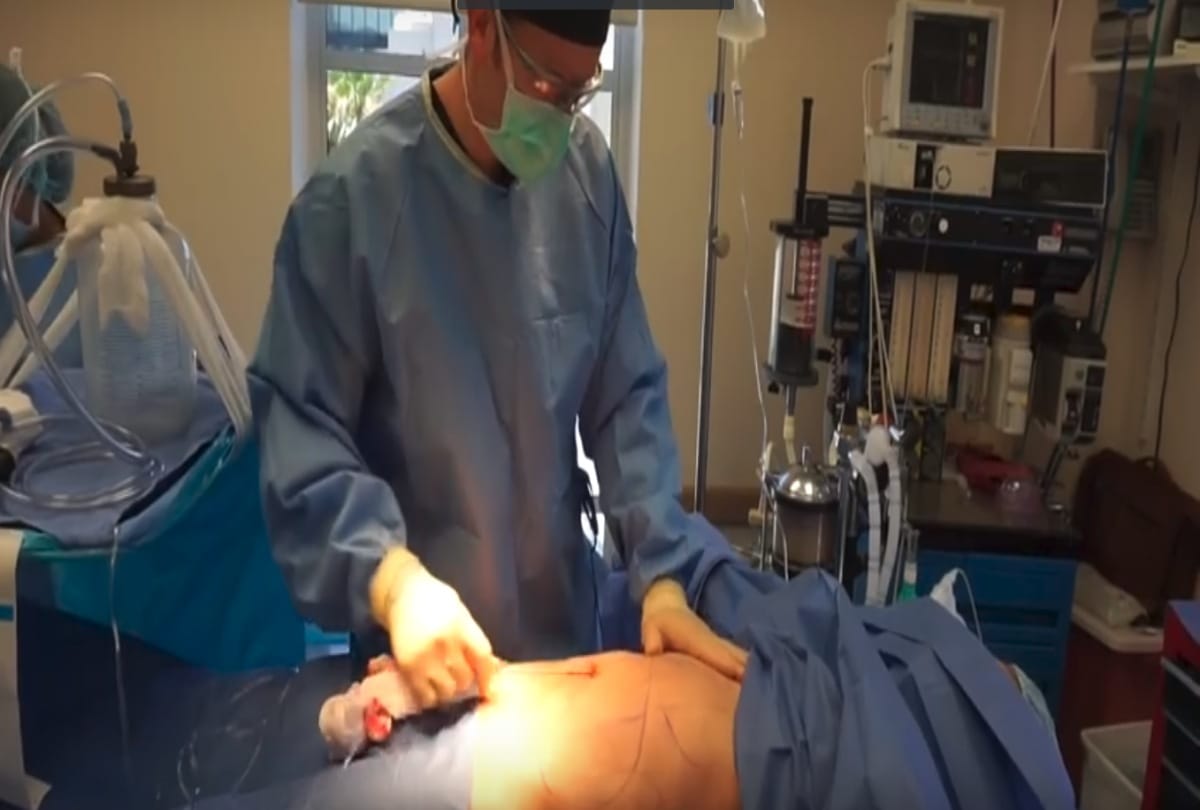 Know about the trend of butt upliftment surgery