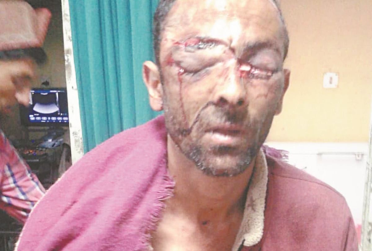 भालू ने गडरिये पर किया हमला