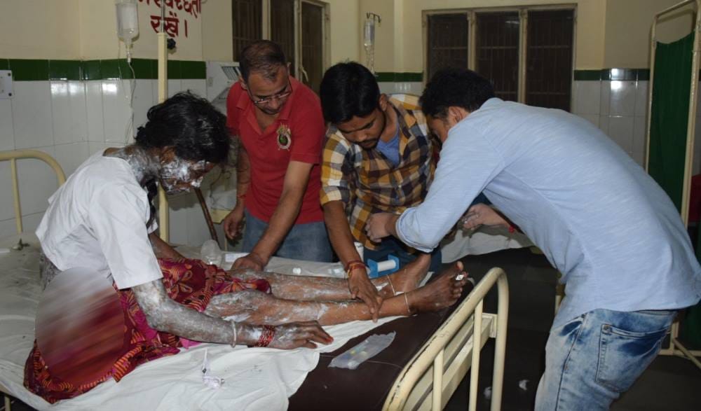 man throw one gallon acid on his family at almora