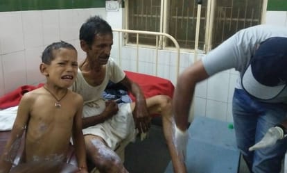 man throw one gallon acid on his family at almora