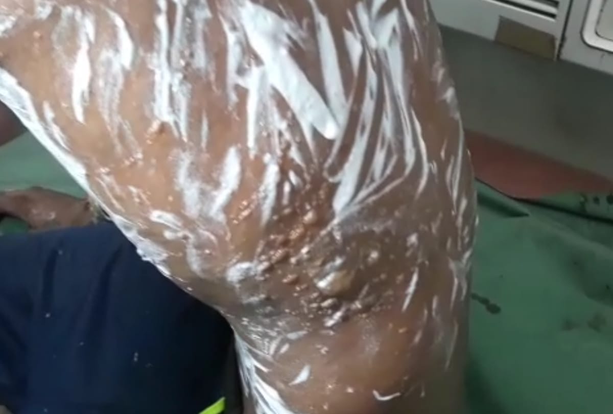 shopkeeper burnt his customer for one rupee in bahraich