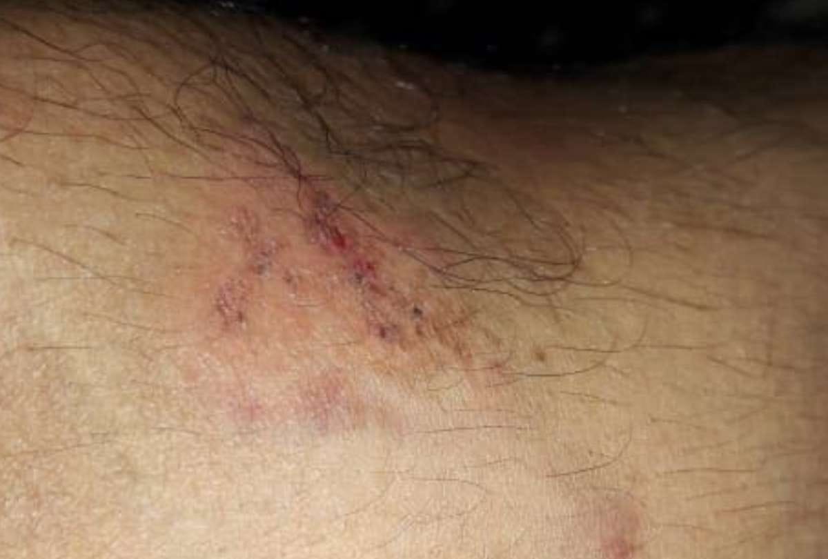 lucknow police beaten man