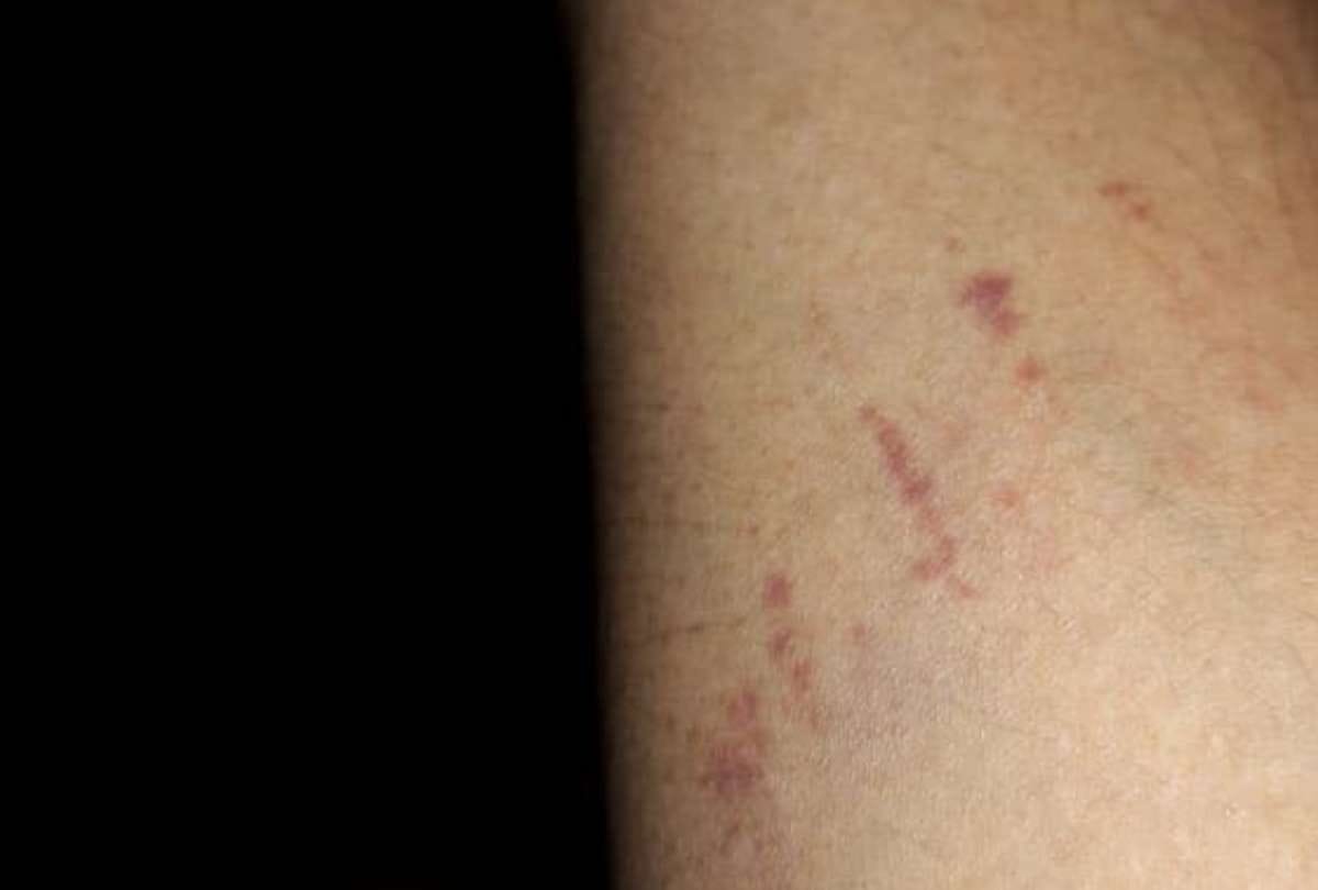 lucknow police beaten man