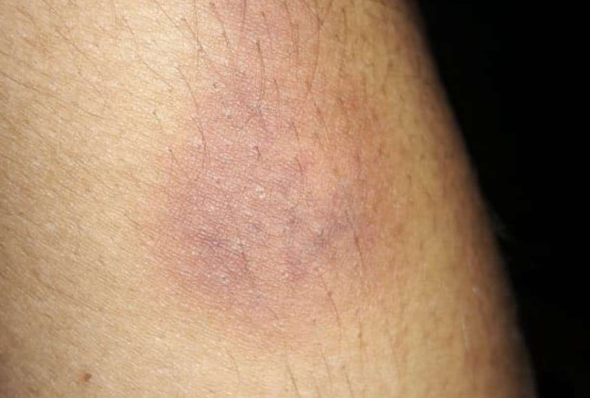 lucknow police beaten man