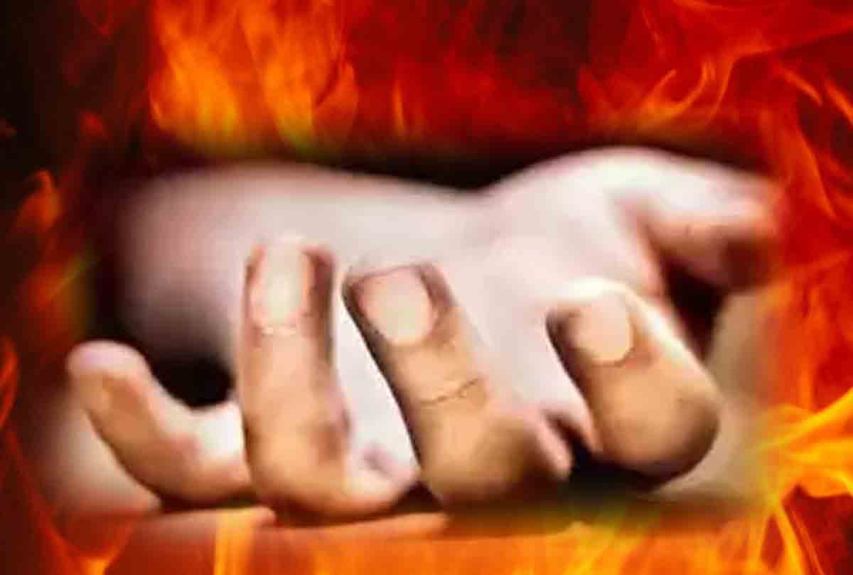girl burned in suspicion of illegal relations Death during treatment