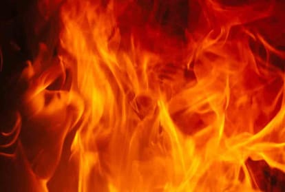 girl burned in suspicion of illegal relations Death during treatment