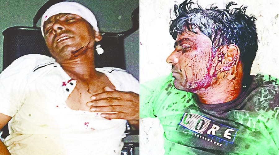 Conflict in two parties in Shamli, and seven people injured