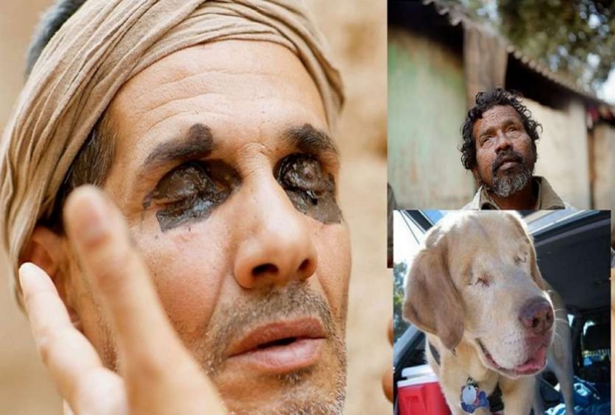 Not only human the animal also blind in this city