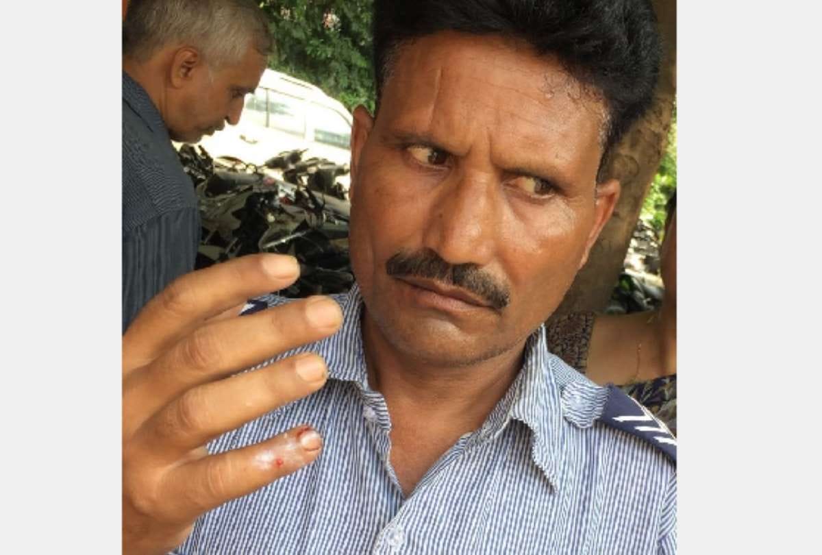 women broken finger of security guard