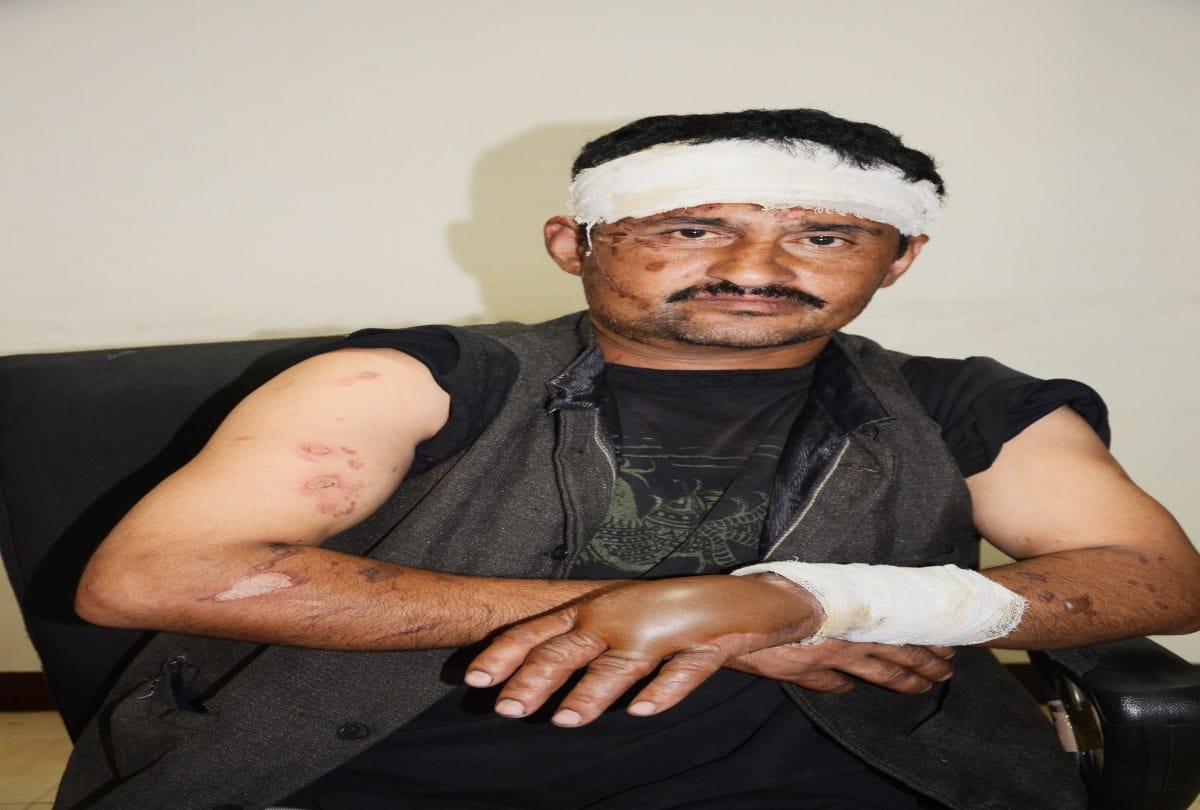 After the quarrel oil pan Poured on the Street vendor in shimla