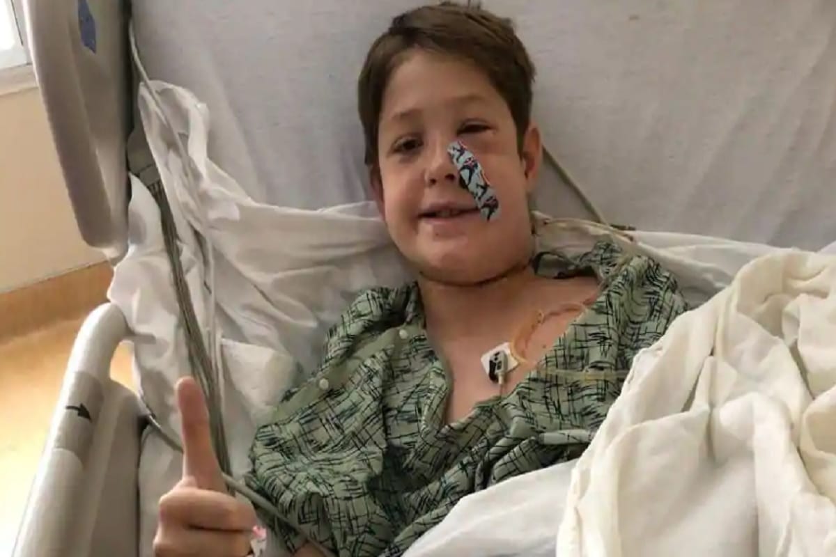 skewer stucked in the skull of american boy, survives