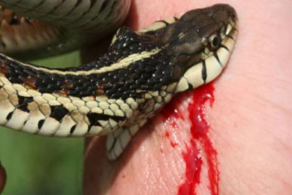 to cure snake bite man covered full body under cow dung in uttar pradesh