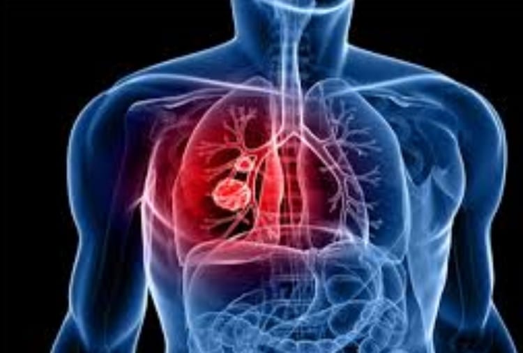 Oatmeal get  to TB patients for two years in Punjab