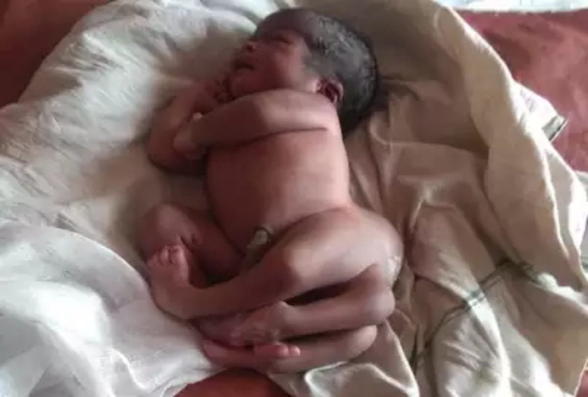 Four footed baby born in gorakhpur at uttar pradesh