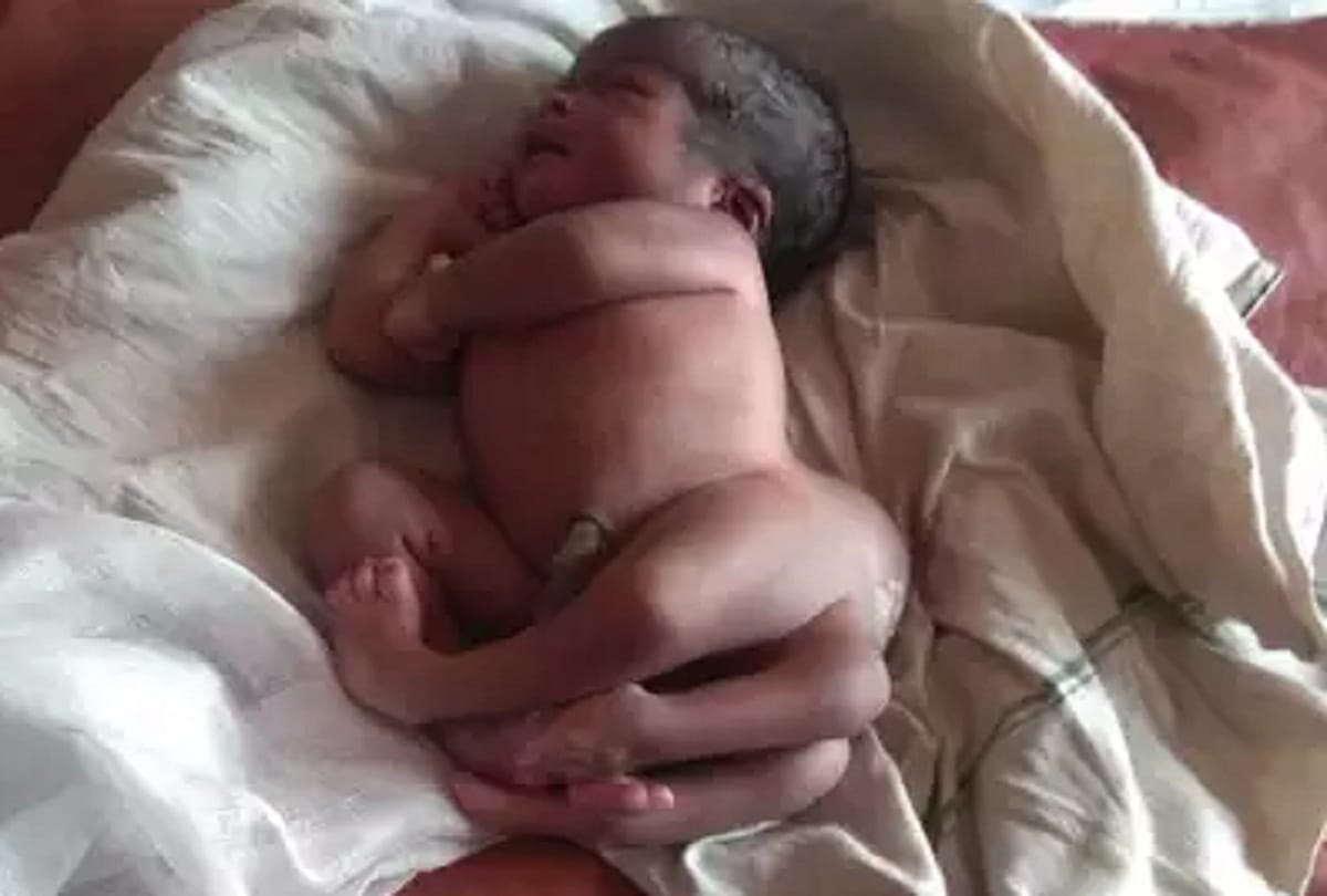 lady birth newborn baby have a four foot in gorakhpur