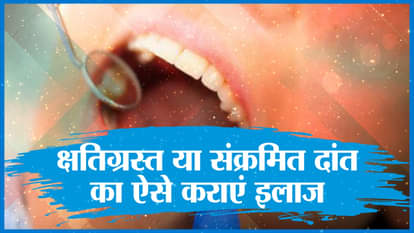 treatment for damaged or infected teeth