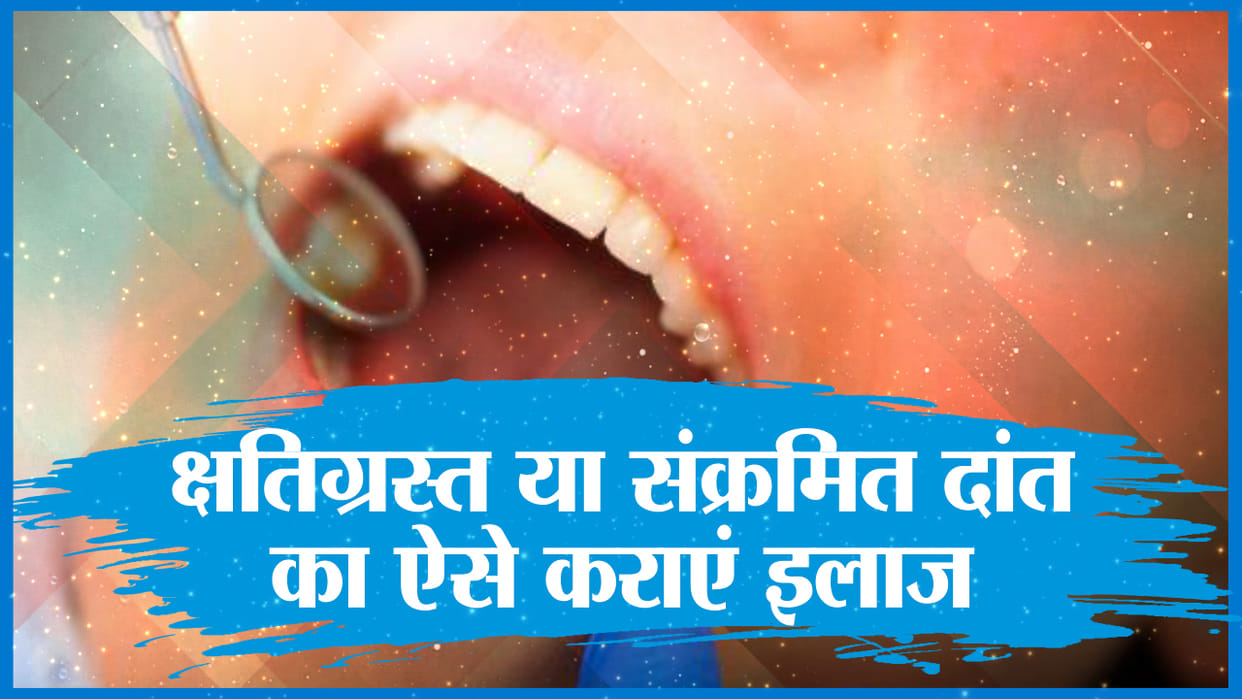 Dental OPD closure for one and a half years, patients trouble
