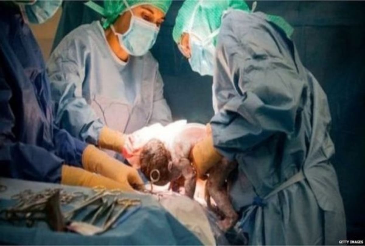 Pregnant women suffer in hospital here nurse used abusive language during treatment