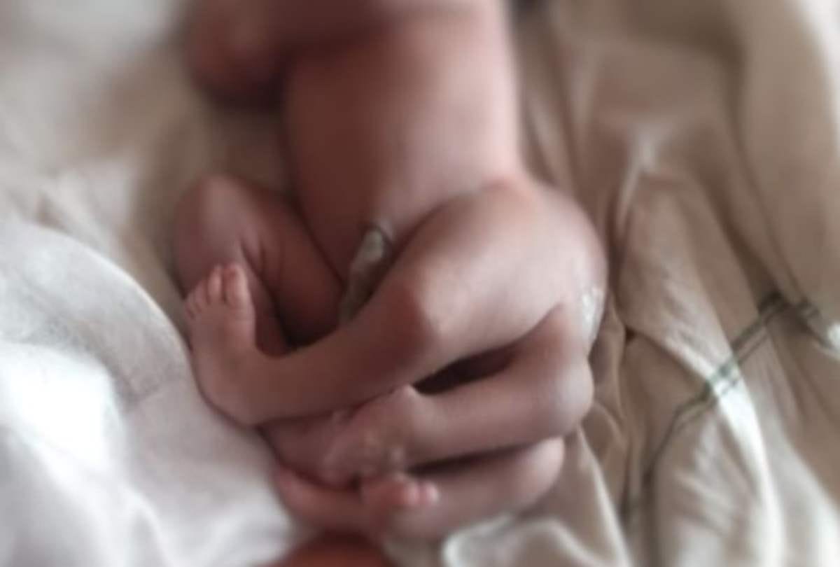 birth defect Why Babies Are Born With Multi Hands And Legs