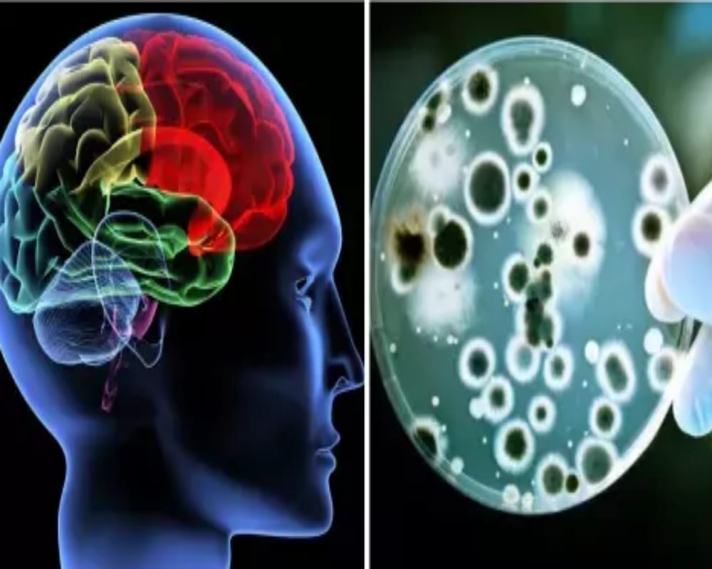 mosquito bite effects: La Crosse Encephalitis spread through mosquitoes bites