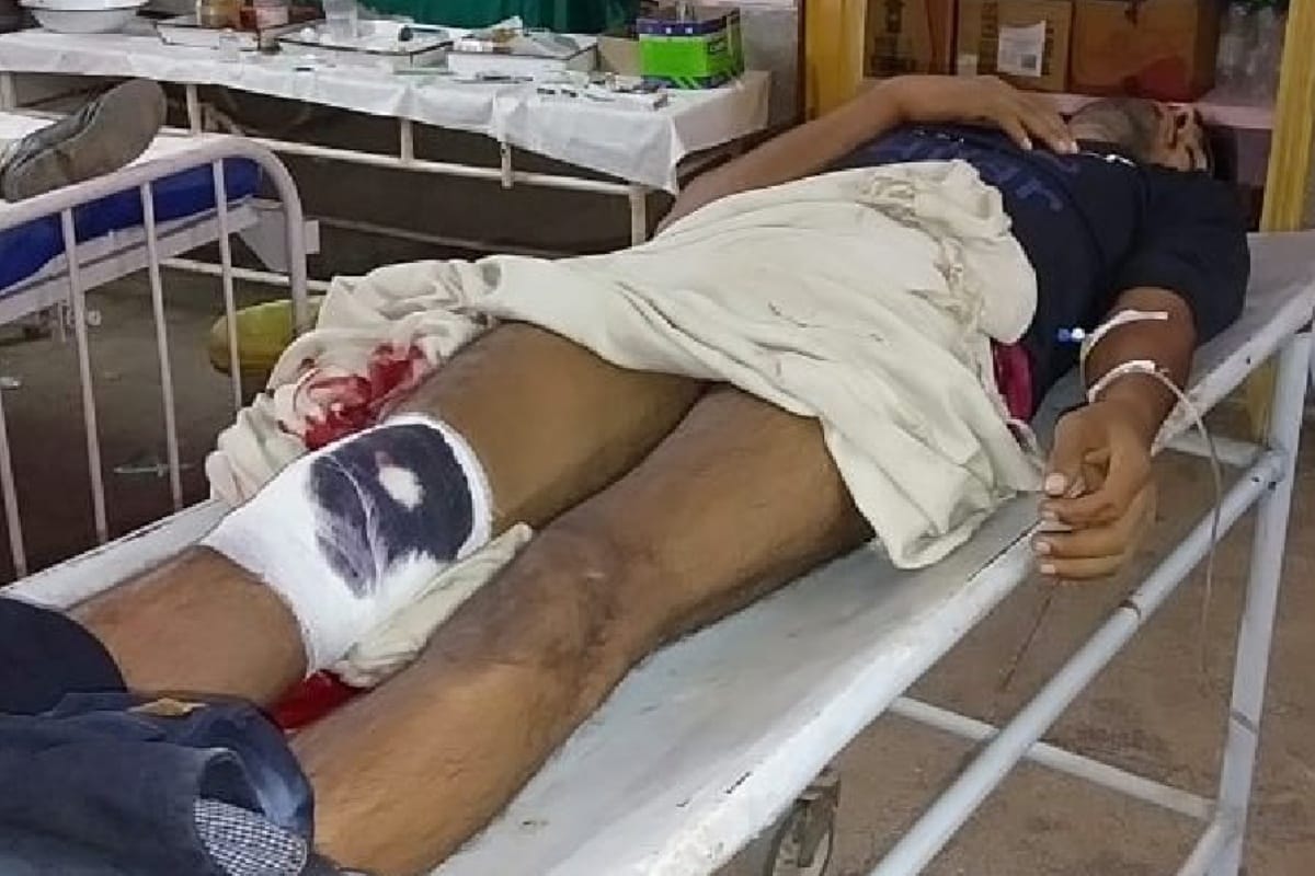 encounter Again in UP police team arrested two badmash with a briefcase of 10 lacks