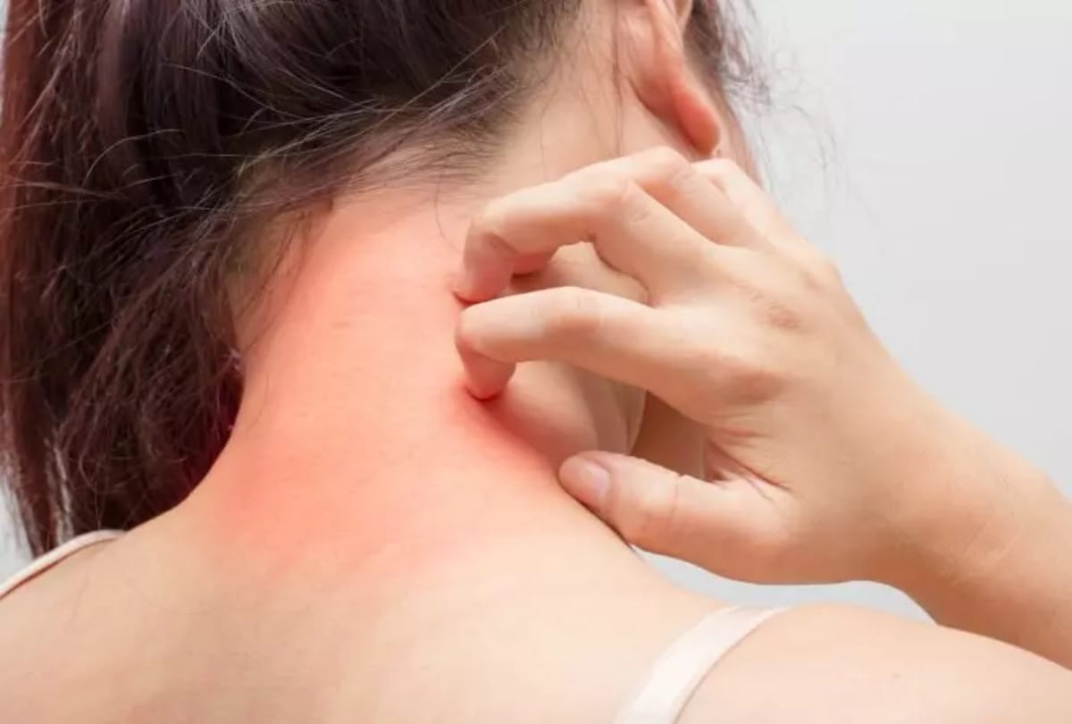 How many times do you scratch a day
