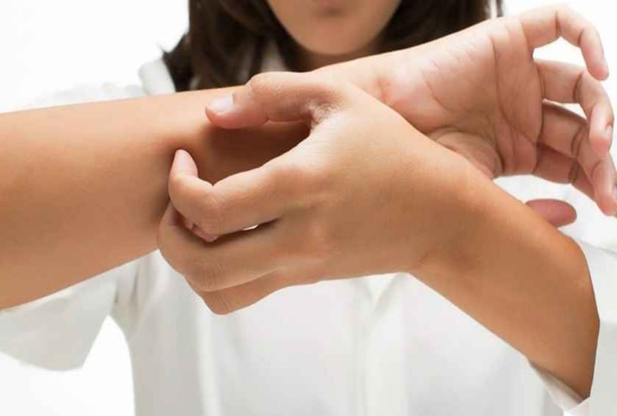 How many times do you scratch a day