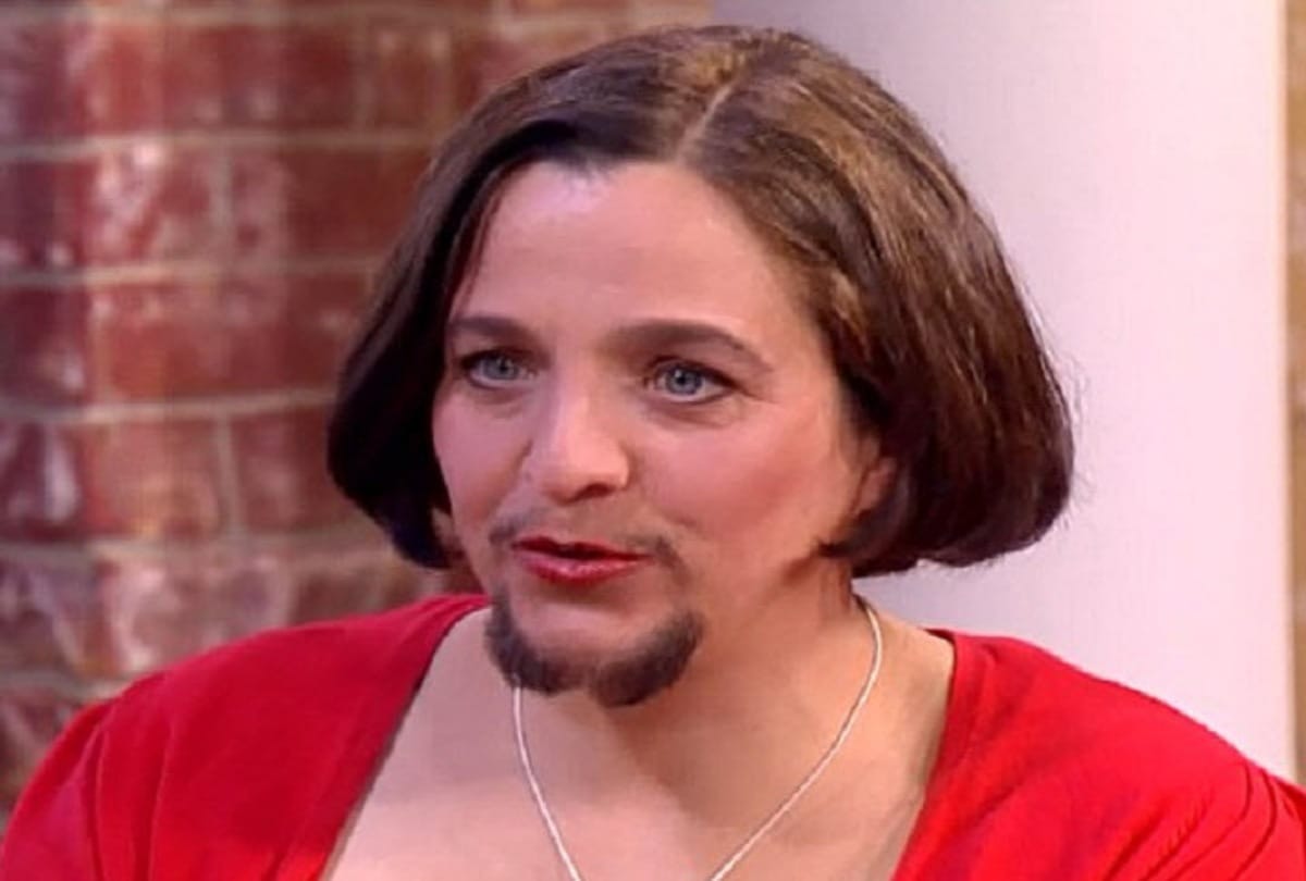 Know Why do the beard grow on girl face