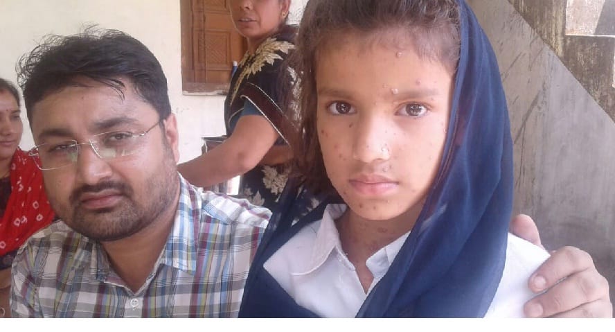 Many children sick, stir in the department after coming out of the chickenpox